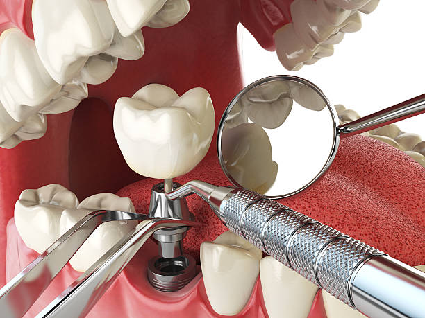 Best Walk-In Emergency Dental Services in Irving, TX